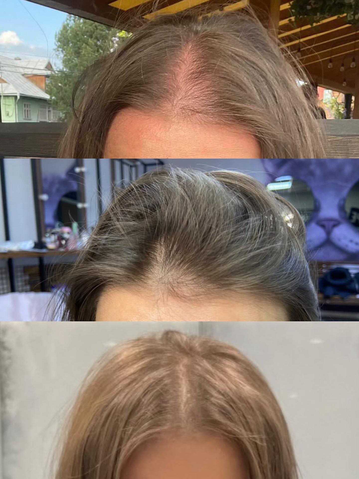 До і після лікування